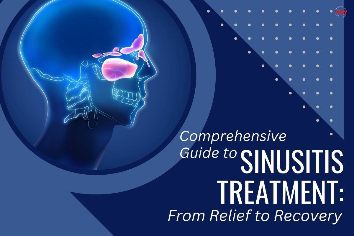 Comprehensive Guide to Sinusitis Treatment: From Relief to Recovery